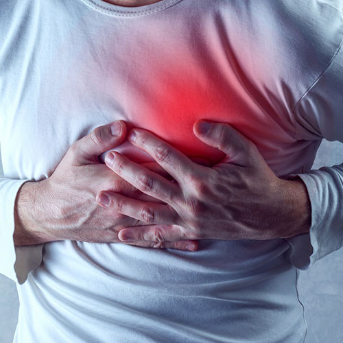 Management of acute myocardial infarction